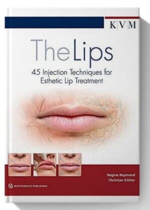 The Lips: 45 Injection Techniques for Esthetic Lip Treatment 1st Edition (Scanned)
