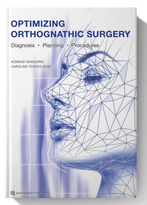 Optimizing Orthognathic Surgery: Diagnosis, Planning, Procedures