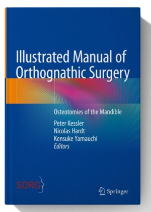 Illustrated Manual of Orthognathic Surgery: Osteotomies of the Maxilla and Midface  (September 30, 2024)