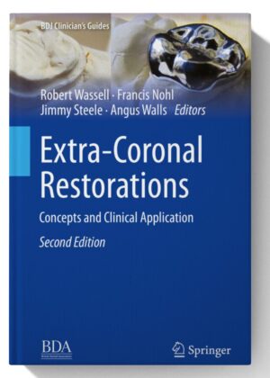 Extra-Coronal Restorations: Concepts and Clinical Application (BDJ Clinician’s Guides) 2nd Edition