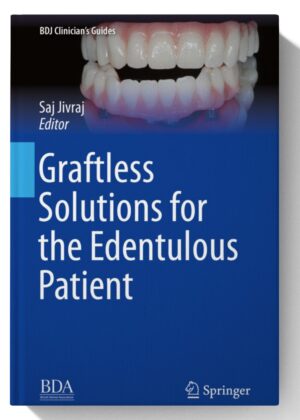 Graftless Solutions for the Edentulous Patient (BDJ Clinician’s Guides)