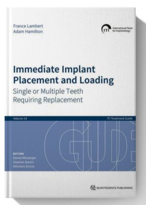 Immediate Implant Placement and Loading: Single or Multiple Teeth Requiring Replacement (ITI Treatment Guides, 14) 1st Edition