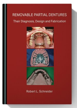 Removable Partial Dentures: Their Diagnosis, Design and Fabrication
