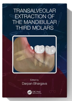 Transalveolar Extraction of the Mandibular Third Molars 1st Edition