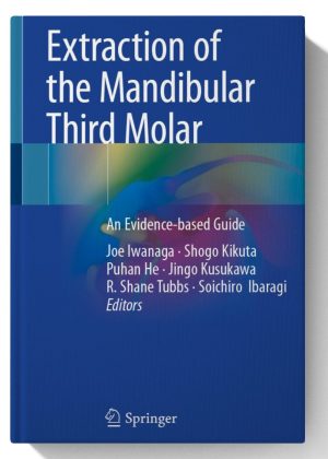 Extraction of the Mandibular Third Molar: An Evidence-based Guide. May 27, 2025