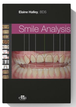 Smile Analysis 1st Edition