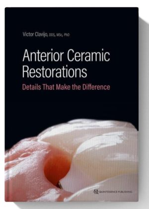 Anterior Ceramic Restorations: Details That Make the Difference