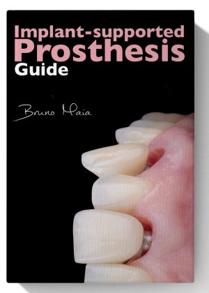 Implant-Supported Prosthesis Guide