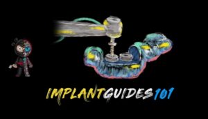 Ninja Implant Guides 101