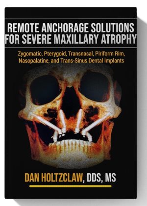 Remote Anchorage Solutions for Severe Maxillary Atrophy: Zygomatic Implants, Pterygoid Implants, Transnasal Implants, Piriform Rim Implants, Nasopalatine Implants, and Trans-Sinus Dental Implants. (Scanned Copy)