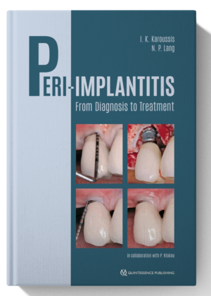 Peri-Implantitis: From Diagnosis to Treatment