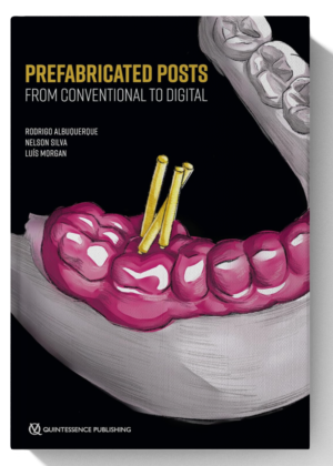 Prefabricated Posts: From Conventional to Digital