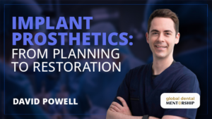 Osteocom Implant Prosthodontics, from Planning to Restoration – David Powell