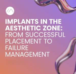 Implants in the Aesthetic Zone: From Successful Placement to Failure Management