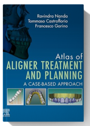 Atlas of Aligner Treatment and Planning: A Case-Based Approach