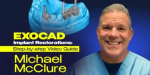 OHI-S EXOCAD Implant Restorations – Step-by-step Video Guide
