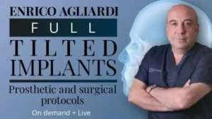 Full Tilted Implants: Prosthetic and Surgical Protocols (Osteocom)