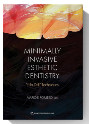 Minimally Invasive Esthetic Dentistry: "No Drill" Techniques